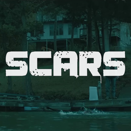 Scars